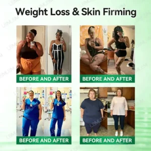 𝐎𝐟𝐟𝐢𝐜𝐢𝐚𝐥 𝐒𝐭𝐨𝐫𝐞 🇺🇸 |FOODLISS™ Moringa·Berberine × NAD+ 10-in-1 Nano Microneedle Patch – Daily, Visible Results in 7 Days ✅ For Weight, Skin, Diabetes & Joint Health 🗽
